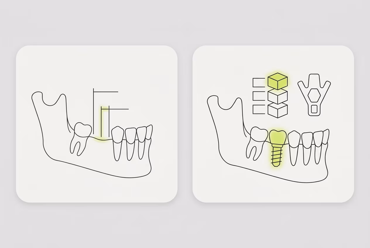 Схема 3D-планирования имплантации зубов в современной клинике Москвы